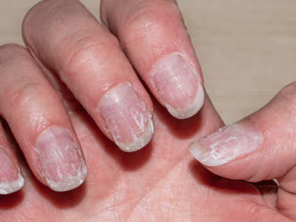 Les 6 signes que vos ongles manquent de soins (et pourquoi les ignorer les fragilise encore plus)